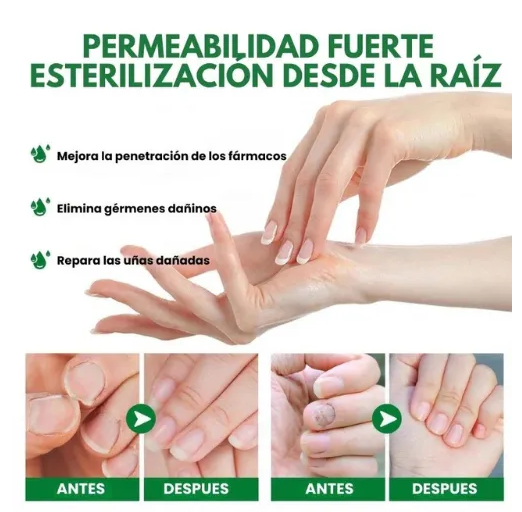 Aceite Para Hongos De Uñas - foto adicional 2